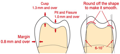 Important Note of Forming