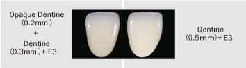 Opaque Dentine