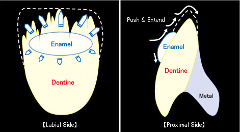 pic Diagram of Enamel build up