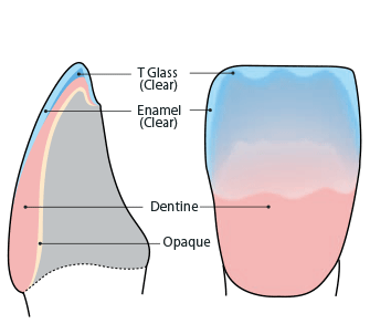 Building-up with T Glass layers 