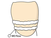 Cervical01