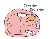 Cusp marginal area01