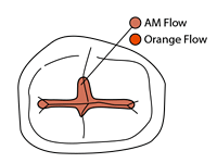 Pit and fissure01